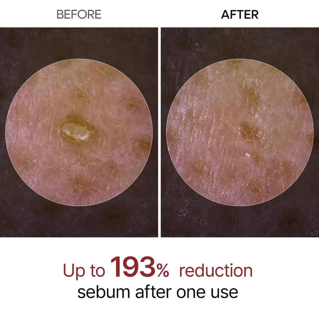 Lumofly™ Peel Shot