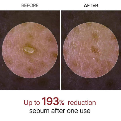 Lumofly™ Peel Shot